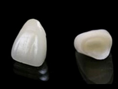 クリスタルミツル歯科 入れ歯 カウンセリング