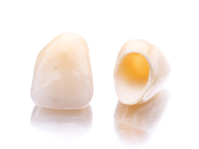 クリスタルミツル歯科 自分一人じゃないから良い結果を目指せる