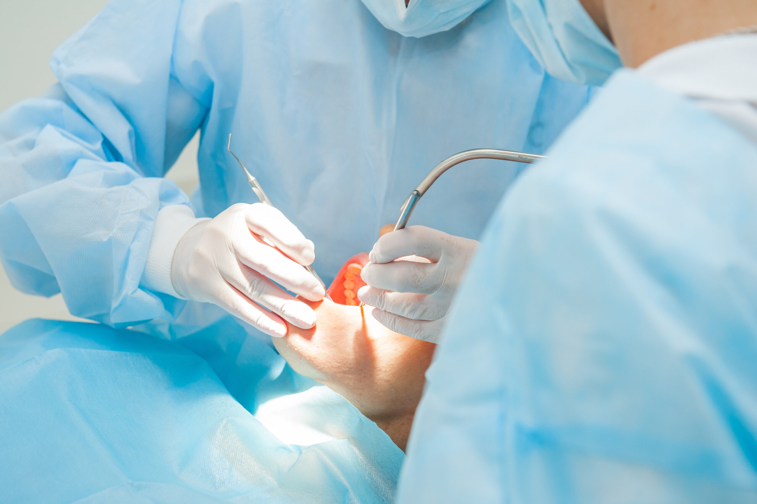 インプラントの手術を行う歯科医師たち