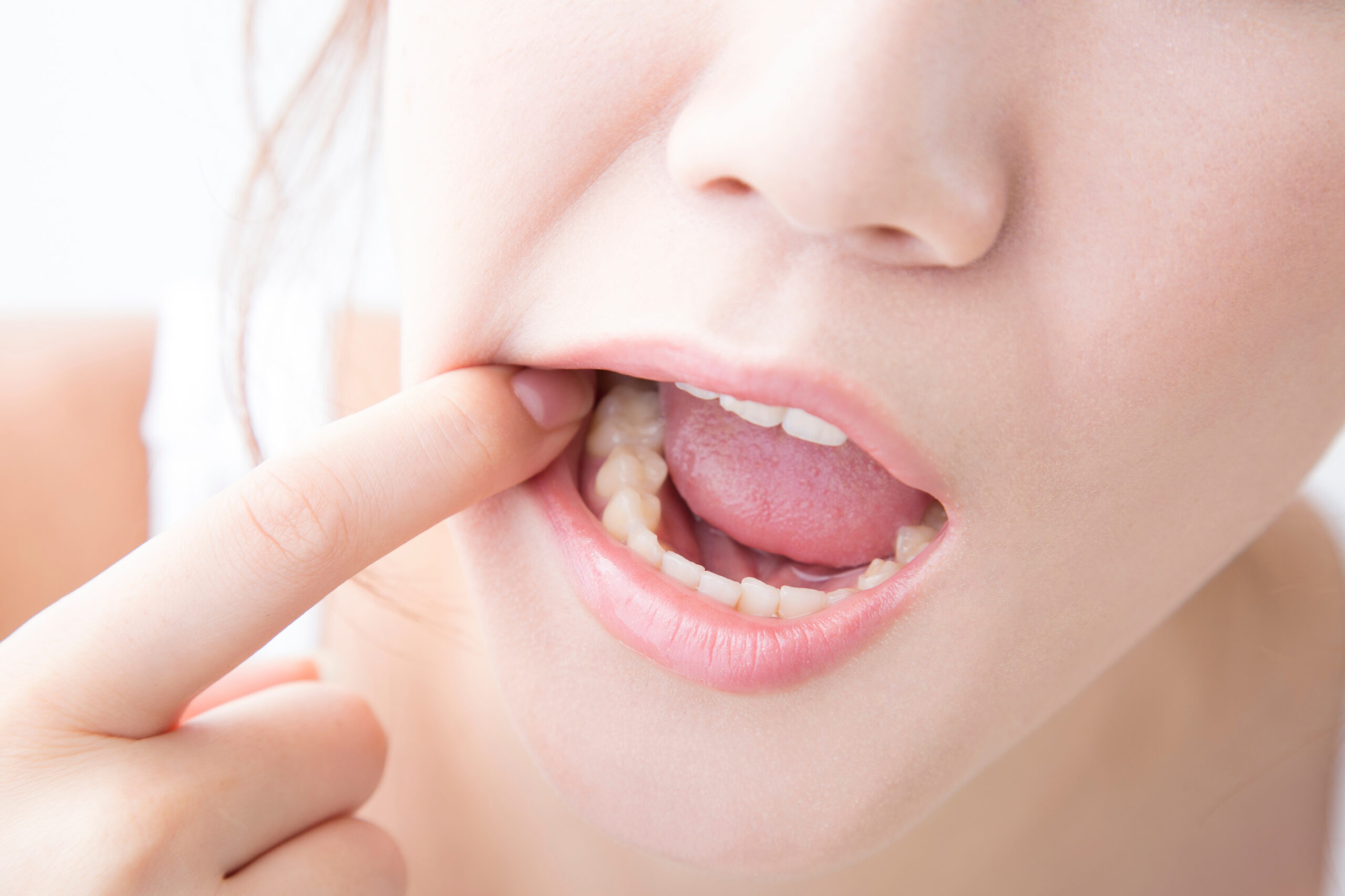 奥歯のインプラントにするメリットとは？歯の健康を取り戻す方法！