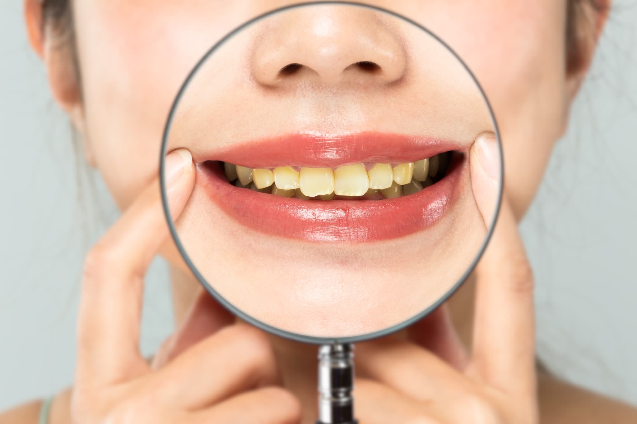 歯の黄ばみの原因は？今すぐできる改善方法・予防法も紹介！
